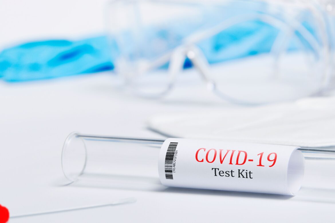 A test tube test kit with label